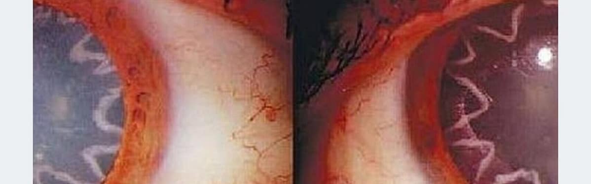 Unspeakable: Beyond The Wall of Sleep (2024)